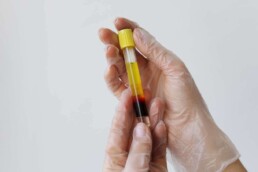 prp therapy pain doctor for arthritis ny
