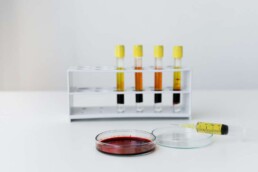 Regenerative Medicine Doctors NY