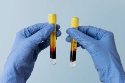 Regenerative Medicine Doctors NY