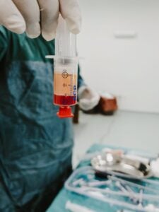 Stem Cell Therapy for Back Pain